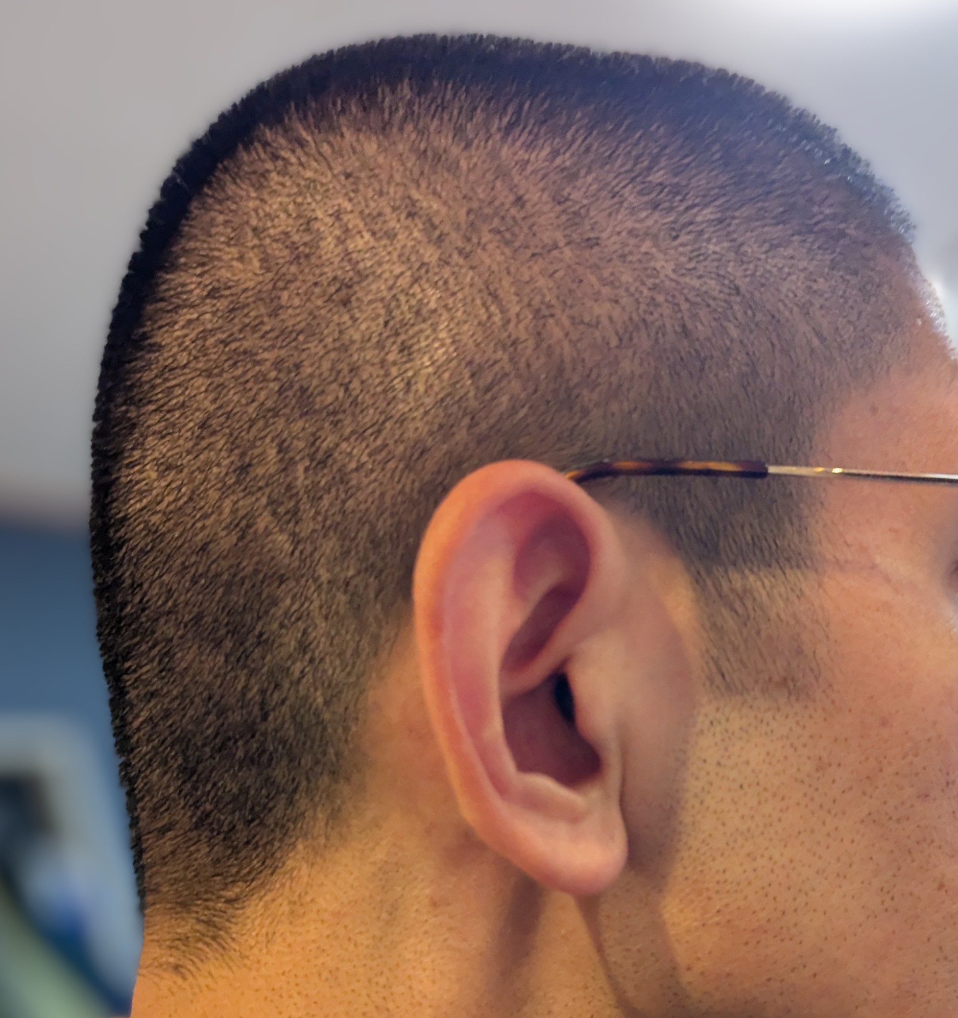 自己選択、自己決定、自己責任と丸刈り